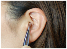 触診・検査photo